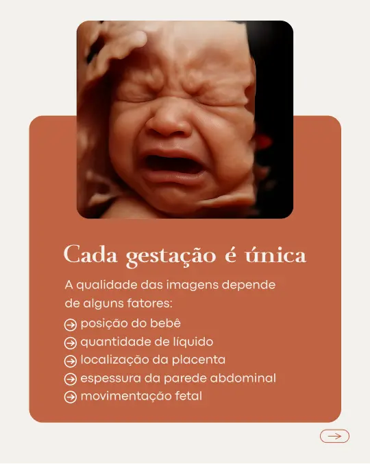 camille-rabbi-portfolio-157-6